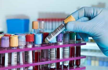 Hematology Technology/Technician Major