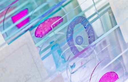 Histologic Technology/Histotechnologist Major